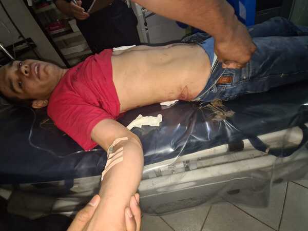 Por celos, hombre apuñaló a otro en medio de una fiesta