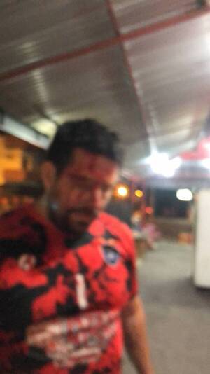 Crónica / [VIDEO] Defendió a su papá que estaba siendo garroteado: "le abrieron la cabeza" he'i