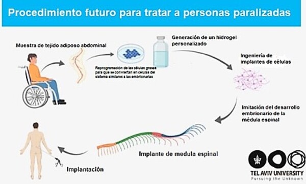 Bioimpresión en 3D: Paralíticos podrían volver a caminar gracias a un sorprendente implante de médula desarrollado en Israel – La Mira Digital