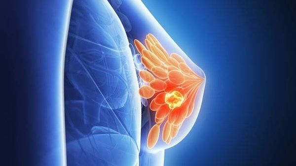 Diario HOY | Salud presenta guía de diagnóstico y tratamiento del cáncer de mama