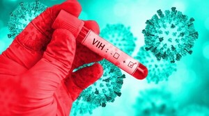 Médicos de EE UU anuncian la primera curación de una mujer con VIH | OnLivePy