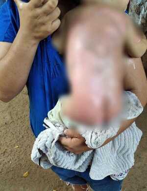 Bebé de 9 meses sufre terribles quemaduras con agua caliente - La Clave