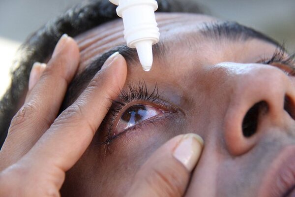 Incendios forestales: Salud emite recomendaciones para evitar daños oculares - ADN Digital
