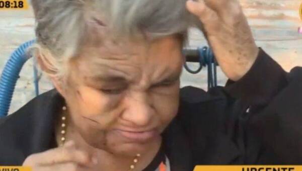 Crónica / ¡Triste! abuelita estaba encerrada en una pieza con heridas y 14 perros