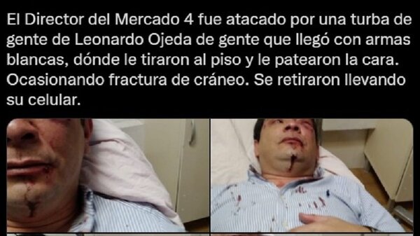 Agreden a director de Mercado 4 | Noticias Paraguay