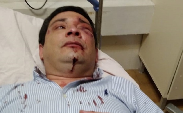 Director del Mercado 4 fue brutalmente agredido a la salida del Canal 13