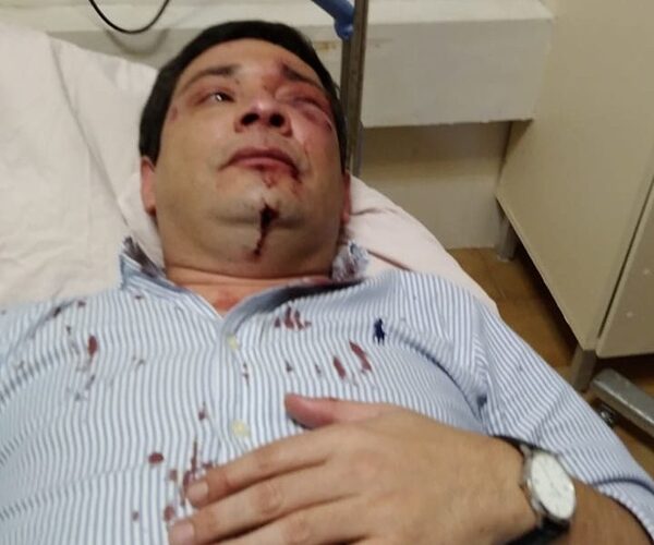 Intendente de Asunción repudia violencia contra capo de Mercados, “el proceso de ordenar el Marcado 4 no se detendrá”, he’i voi