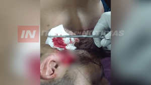 FUE AL VOLEY Y TERMINÓ CON UN BOTELLAZO EN LA CABEZA  - Itapúa Noticias