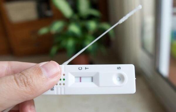 Brasil: con el fin de detectar más casos de Covid-19, aprueban primer registro de autotest