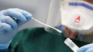Salud reporta leve descenso de casos de Covid-19 con 811 positivos y 8 fallecidos