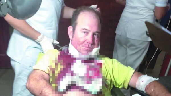 Se enojó porque chofer no le despertó y le clavó en el cuello