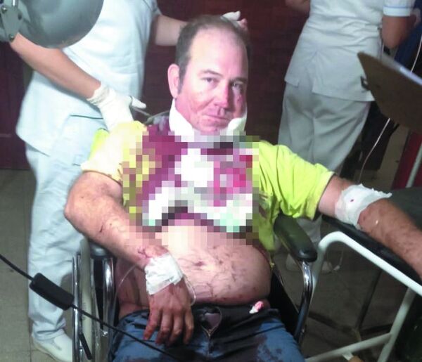 Se enojó porque chofer no le despertó y le clavó en el cuello
