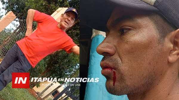 FUE PARA COBRAR POR UN TRABAJO DE ALBAÑILERÍA Y TERMINÓ GARROTEADO - Itapúa Noticias