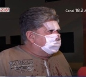 Denuncian por agresión a funcionario de un hotel - Paraguay.com