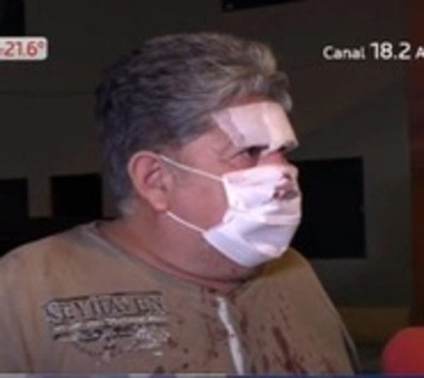 Denuncian por agresión a funcionario de un hotel - Paraguay.com