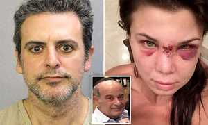 Ex médico trató de estrangular a su novia y mató a tiros a su padre - OviedoPress
