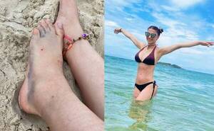 Crónica / Modelo fue a vacacionar pero terminó quedando coja