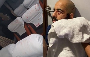 Arquero casi pierde un ojo en ataque de hinchas