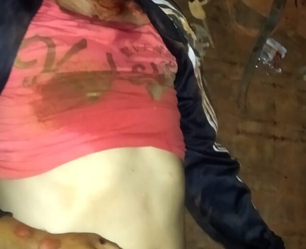 Un muerto y un herido en choque demoto contra automóvil en Cedrales – Diario TNPRESS