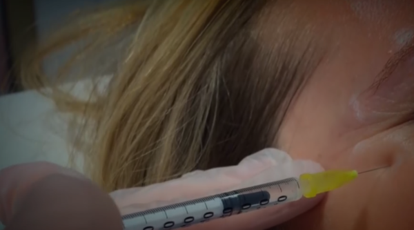 Diario HOY | Advierten sobre venta de Botox ilegal en nuestro país: es un riesgo para la salud