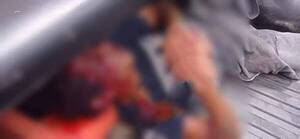 Crónica / Rabioso perro atacó a ladronzuelo que intentaba asaltar a una mujer