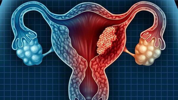 Diario HOY | Detección precoz ayuda a curar el cáncer de cuello uterino