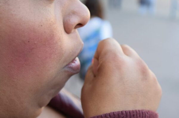 Casi 50 pacientes internados con tuberculosis en INERAM
