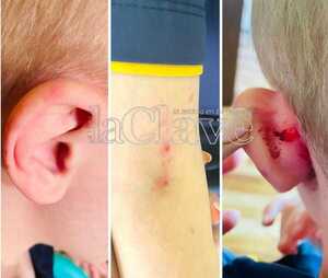 Profesora propinó golpes a un pequeño alumno con discapacidad - La Clave