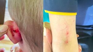 Acusan a profe de agredir con arañazos a alumnito con discapacidad