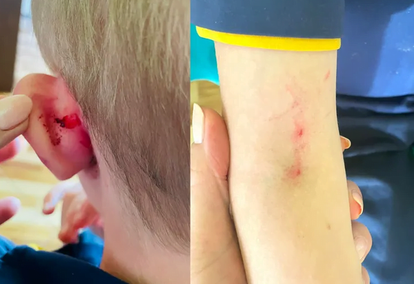 Denuncian que una profesora agredió a su alumnito con discapacidad - Noticiero Paraguay