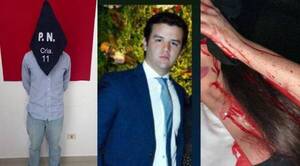Crónica / Se entregó René Olmedo a la policía tras ser procesado por agresión