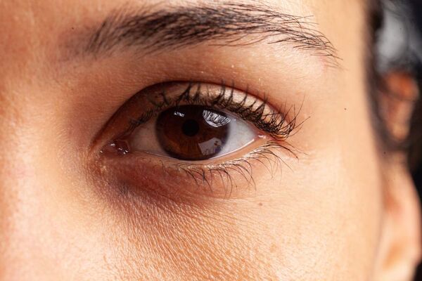 La piel debajo de los ojos: la más sensible para cuidar