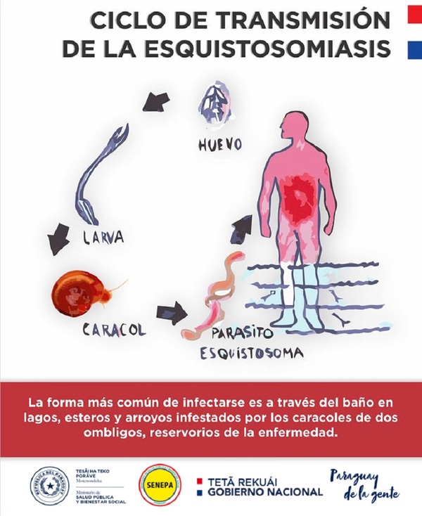 Diario HOY | ¿Qué es la Esquistosomiasis y cómo se transmite?
