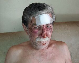 Maleantes atacan a veterano reportero gráfico cuando llegaba a su casa  - Nacionales - ABC Color