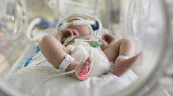 Diario HOY | Bebé está intubado en terapia intensiva con neumonía grave por Covid-19