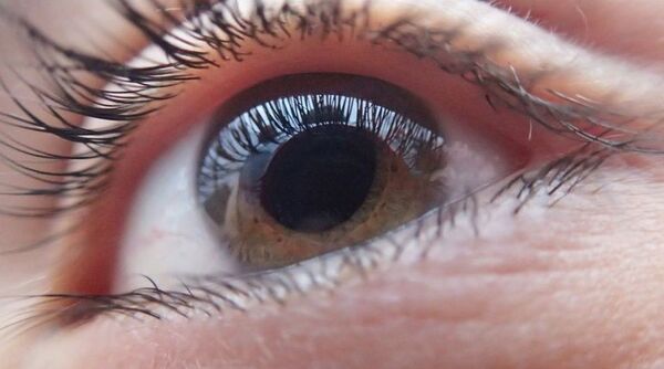 Hoy se recuerda el Día Mundial del Glaucoma, el ladrón silencioso de la visión - Nacionales - ABC Color