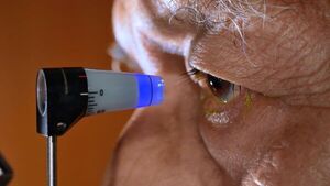 Glaucoma: una enfermedad silenciosa que puede provocar ceguera - San Lorenzo Hoy