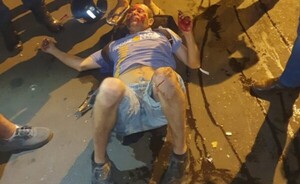 Motociclista embiste frontalmente contra camión en el microcentro
