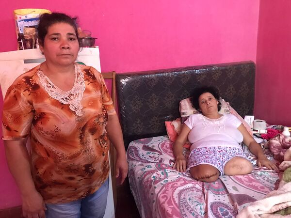 Mujer perdió sus piernas, vive bajo el cuidado de su hermana y solicita ayuda