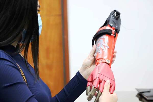 Acuerdan brindar una nueva oportunidad con prótesis en 3D •