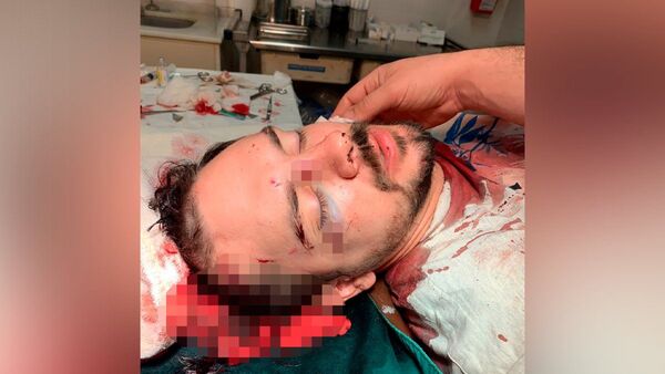 Denuncian agresión de mujer en discoteca y defensa habla de acoso