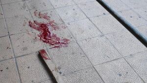 Golpean a un septuagerio con palo - Radio Imperio