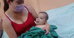 La Nación / Smile Train: niños con labio y paladar hendido fueron operados con éxito en el Hospital de Clínicas