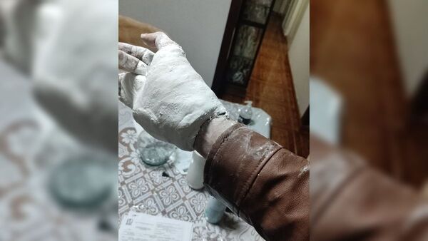 Se accidentó, le pusieron yeso en la mano y ya no pudo quitarse la campera
