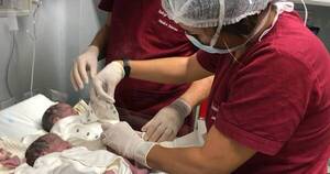 La Nación / Trillizas idénticas ya nacieron y están súperbien