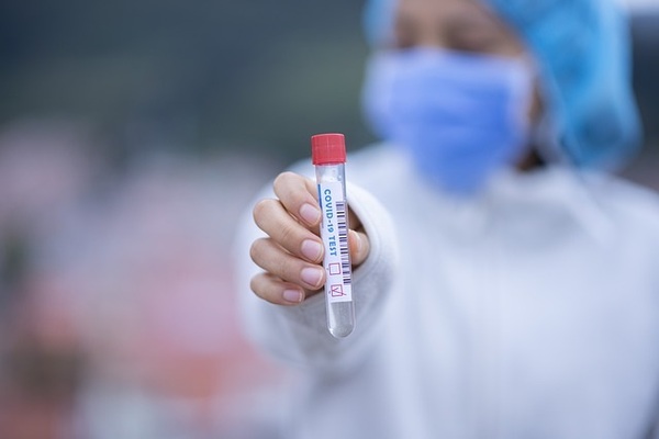 Salud reporta tres fallecidos y 110 positivos