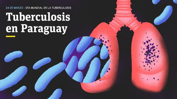 Tuberculosis: notifican 2.983 casos de la enfermedad infecciosa, 96 de estos en niños - Nacionales - ABC Color