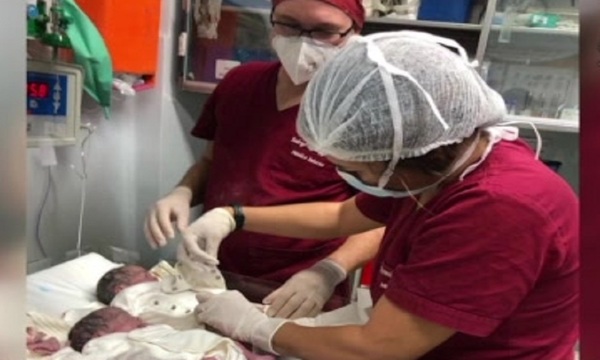 Inédito caso: Nacieron en Paraguay trillizas idénticas - SNT