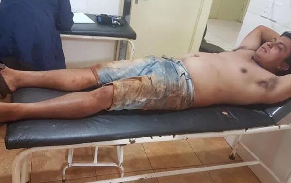 Durante cobertura agreden a comunicador en Canindeyú – Prensa 5