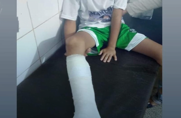 Niño se fracturó el tobillo jugando al fútbol y falleció días después - Noticiero Paraguay